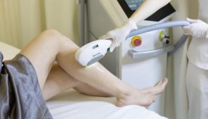 Dịch vụ spa làm đẹp triệt lông vĩnh viễn